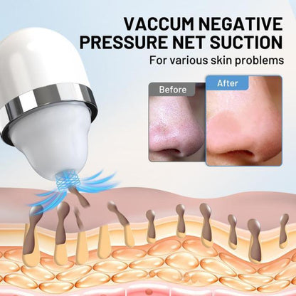 🔥Limited Time 50% OFF⚡Visible Exfoliator Vacuum Cleaner, Skin Scrubber with Camera