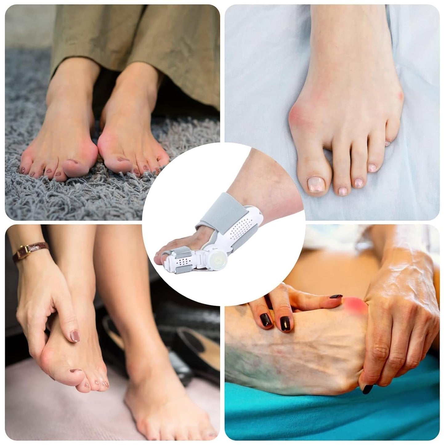 🔥Big Promotion 49% OFF💥Orthopedic Bunion Corrector - stavogue
