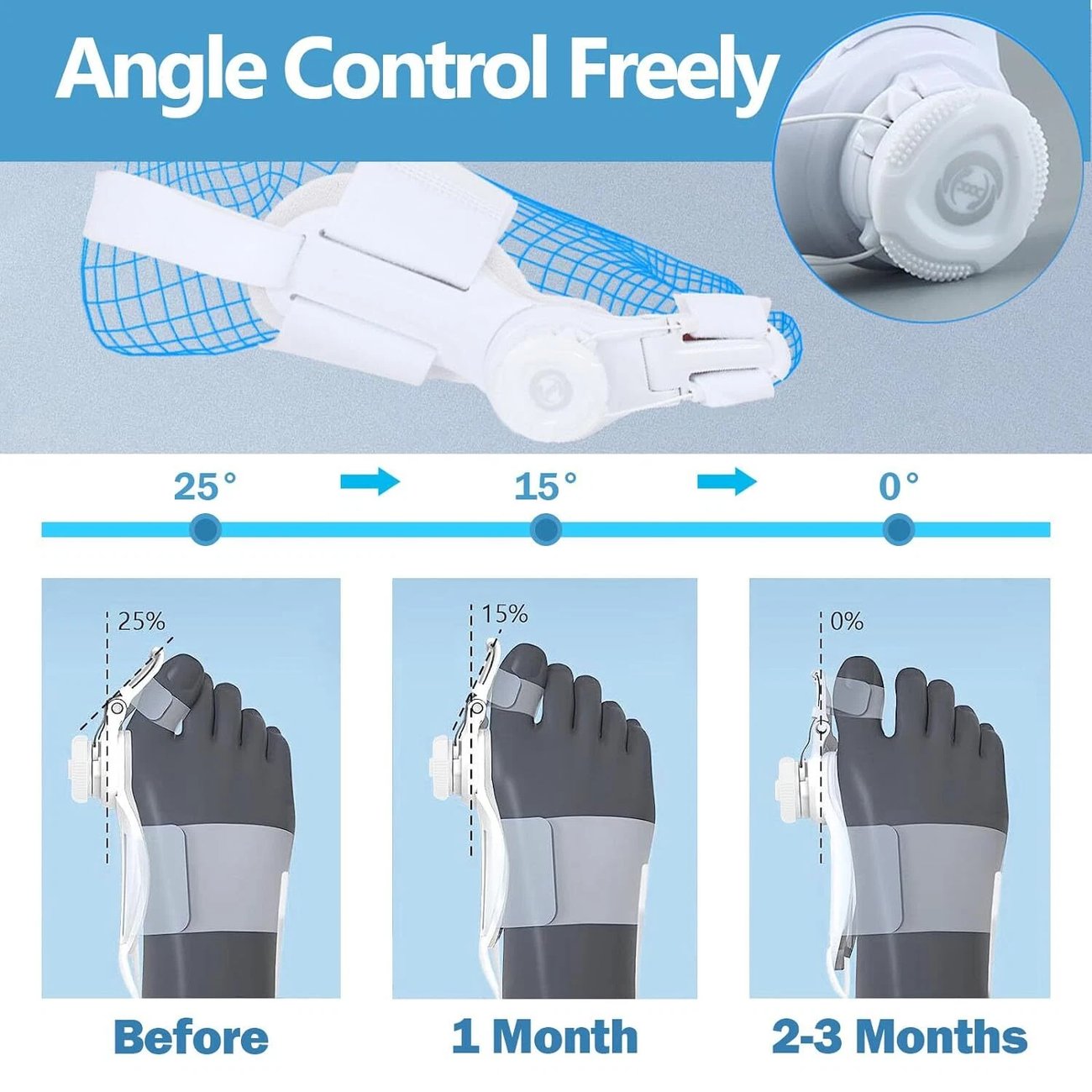 🔥Big Promotion 49% OFF💥Orthopedic Bunion Corrector - stavogue