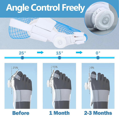 🔥Big Promotion 49% OFF💥Orthopedic Bunion Corrector - stavogue