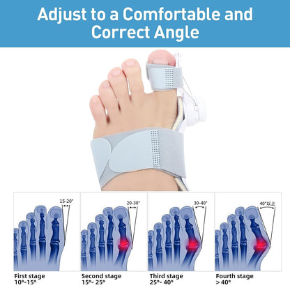 🔥Big Promotion 49% OFF💥Orthopedic Bunion Corrector - stavogue