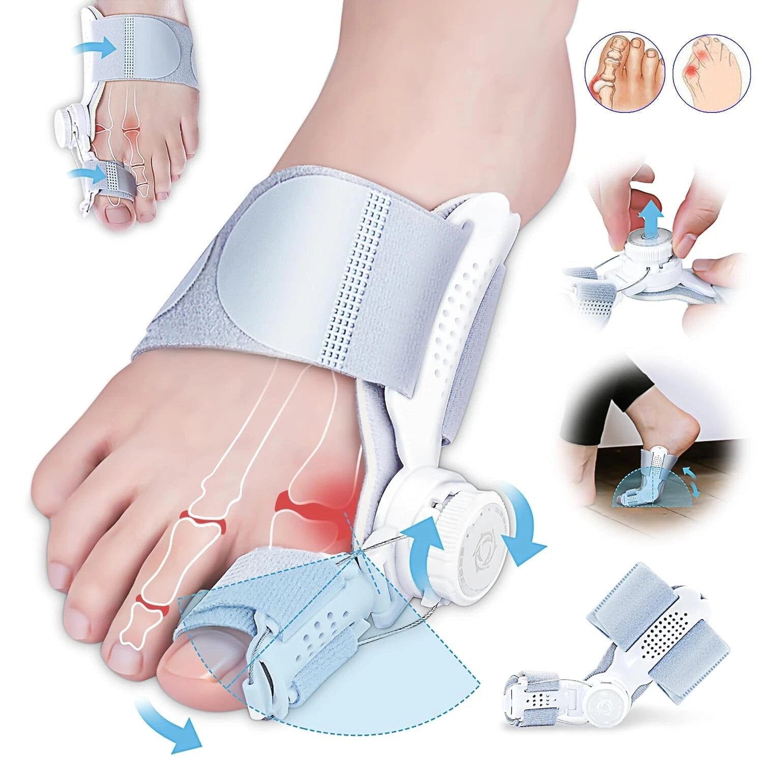 🔥Big Promotion 49% OFF💥Orthopedic Bunion Corrector - stavogue