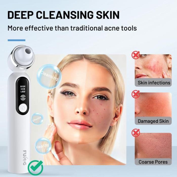 🔥Limited Time 50% OFF⚡Visible Exfoliator Vacuum Cleaner, Skin Scrubber with Camera - stavogue