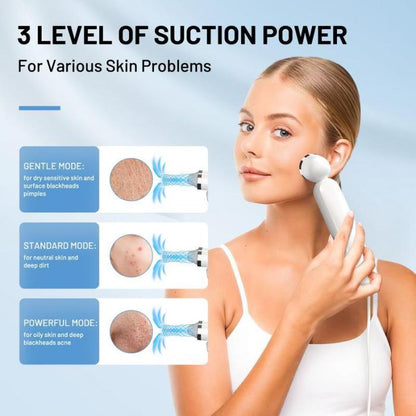 🔥Limited Time 50% OFF⚡Visible Exfoliator Vacuum Cleaner, Skin Scrubber with Camera - stavogue