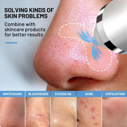 🔥Limited Time 50% OFF⚡Visible Exfoliator Vacuum Cleaner, Skin Scrubber with Camera - stavogue