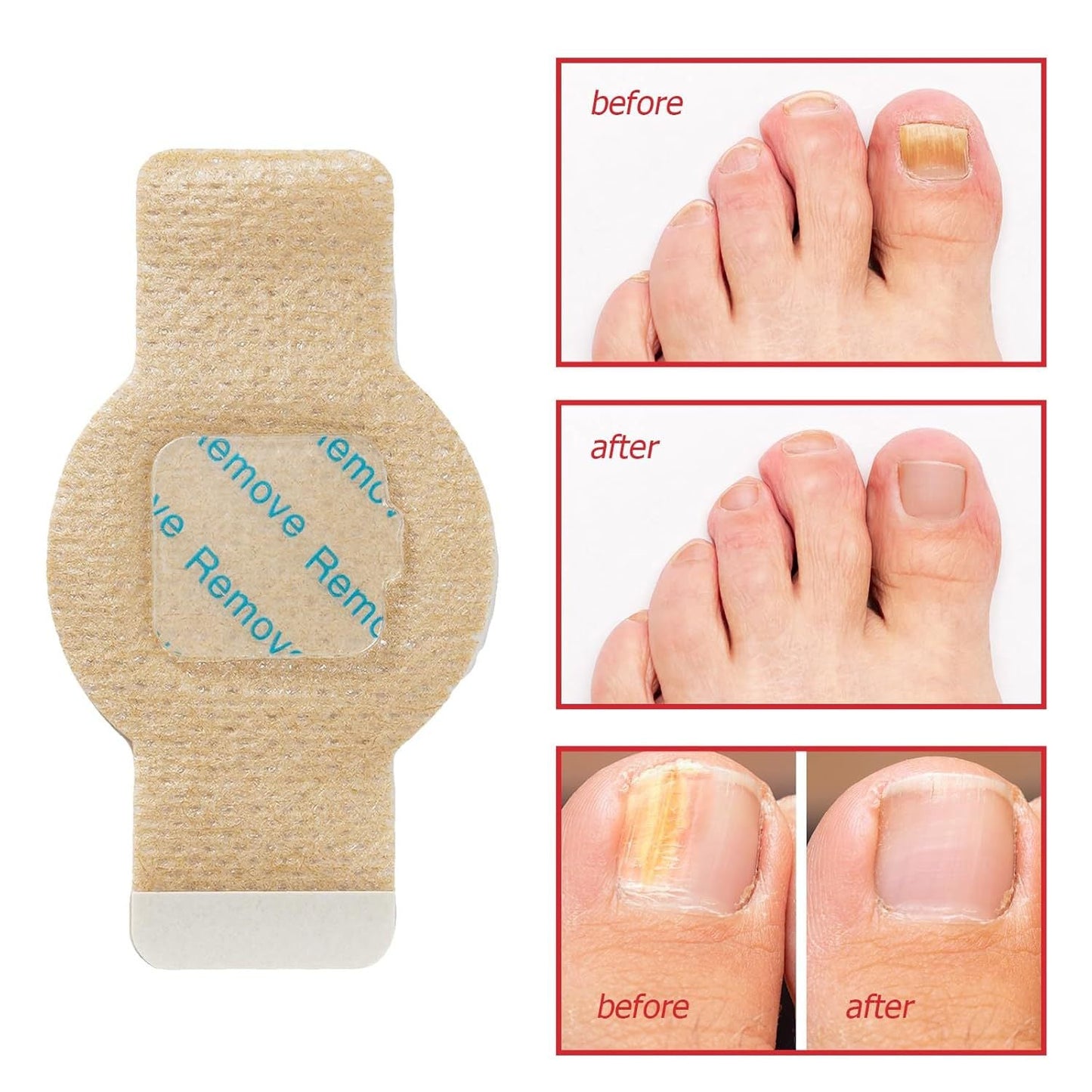 Nail Care Patches, 21pcs/box Nail Health Care Patches with 5 Herbs for Solving Nail Problems - stavogue