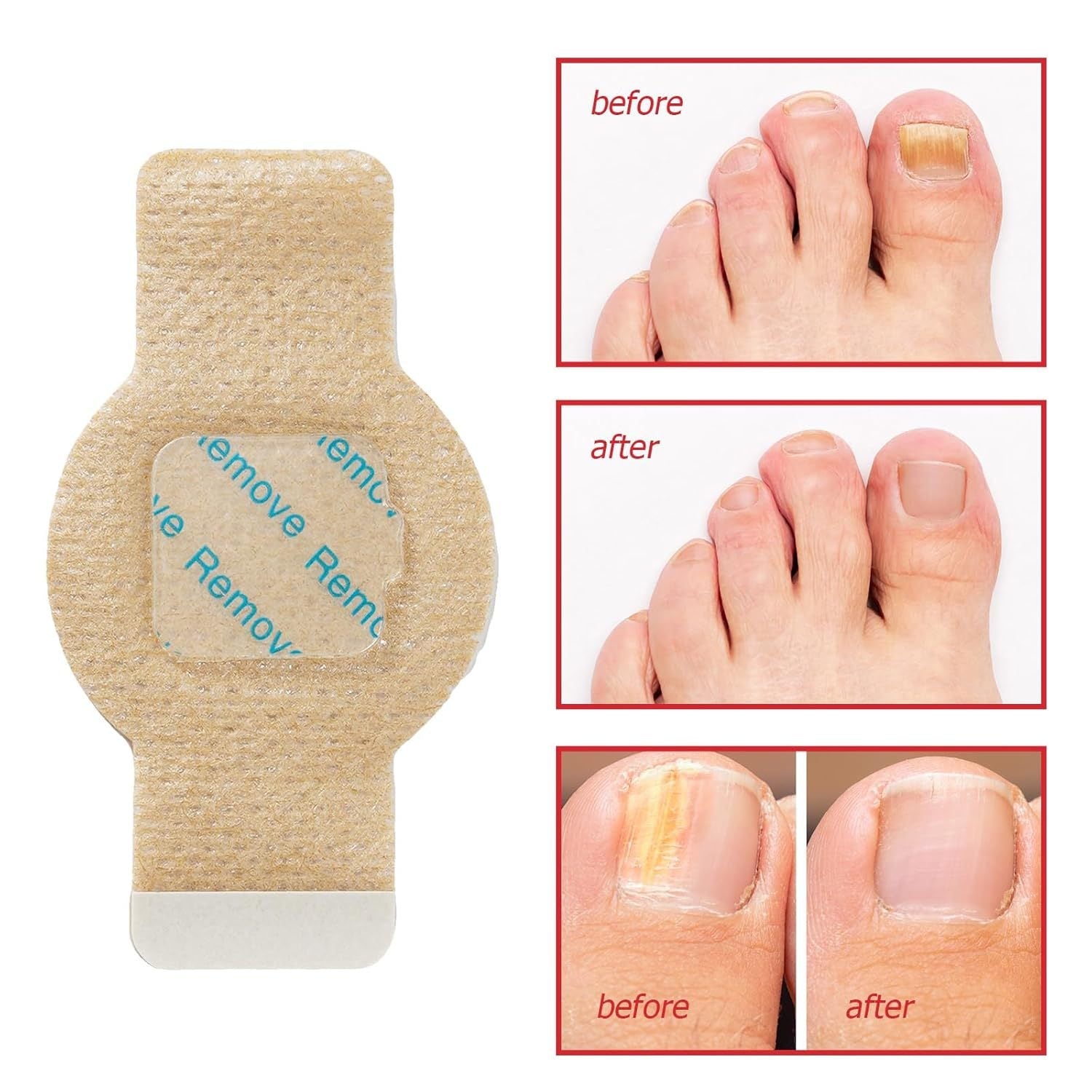 Nail Care Patches, 21pcs/box Nail Health Care Patches with 5 Herbs for Solving Nail Problems - stavogue