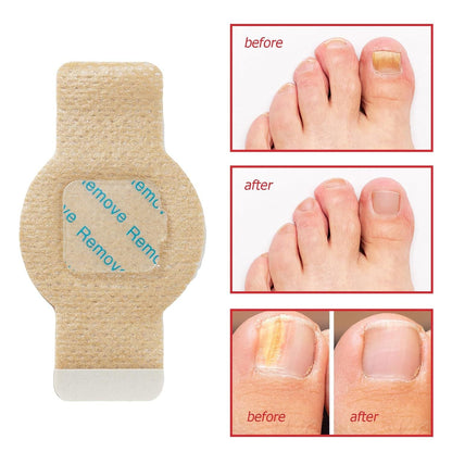 Nail Care Patches, 21pcs/box Nail Health Care Patches with 5 Herbs for Solving Nail Problems - stavogue