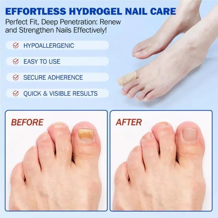 Nail Health Care Patches, Nail Fungus Care Patches, Suitable for Solving Fungal Nails and Other Nail Problems（21 Patches） - stavogue