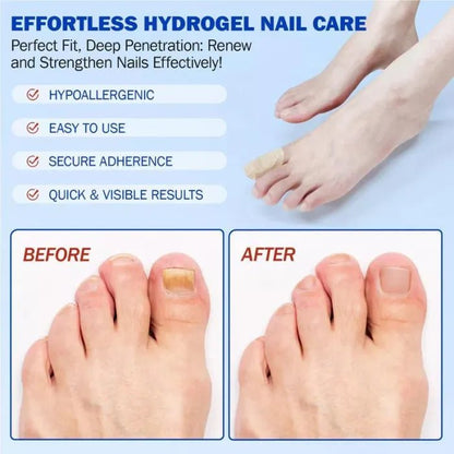 Nail Health Care Patches, Nail Fungus Care Patches, Suitable for Solving Fungal Nails and Other Nail Problems（21 Patches） - stavogue